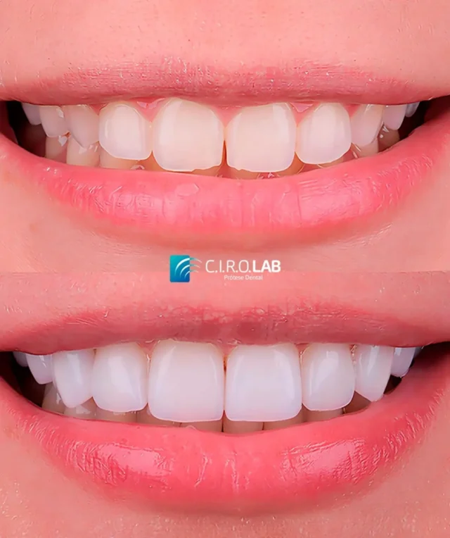 Por trás de um belo sorriso existe o C.I.R.O. Lab